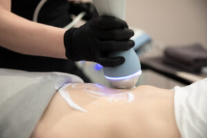 Emtone, one of our Med Spa Services in Elko New Market